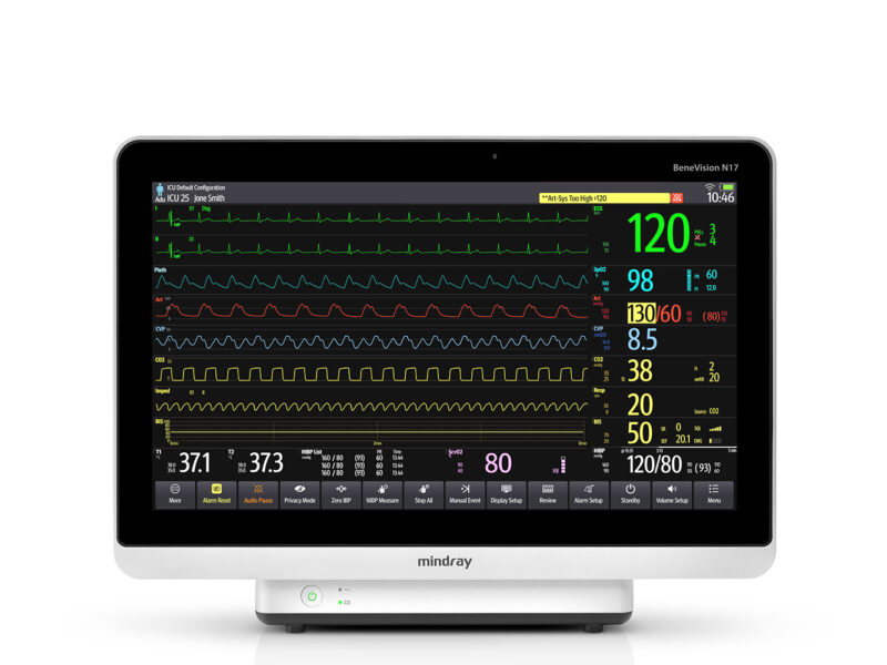 BeneVision N17